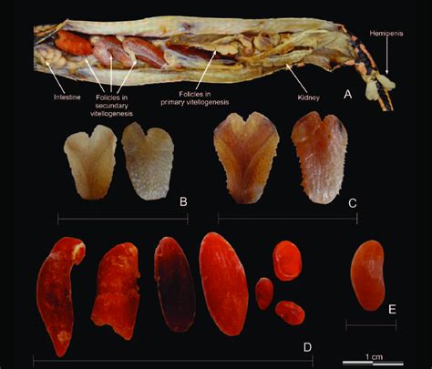 External Genitalia of an Intersex Individual